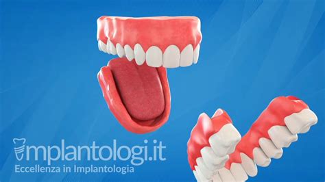 dentiera prada|Altro.